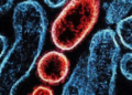Virus Nipah: ¿Qué es?