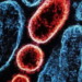 Virus Nipah: ¿Qué es?