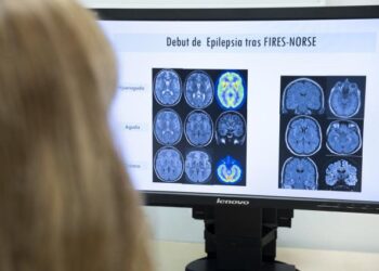 Salut ensaya un Código Crisis Epilepsia para atender a los casos más graves