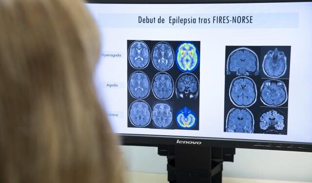Salut ensaya un Código Crisis Epilepsia para atender a los casos más graves