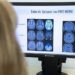 Salut ensaya un Código Crisis Epilepsia para atender a los casos más graves